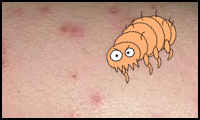 Les Piqures De Puces Anti Puce Les Piqures De Puces Anti Puce
